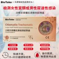 BIOTEKE-沙眼衣原體抗原檢測試劑盒/男性/女性衣原體感染檢測/慢性傳染病檢測